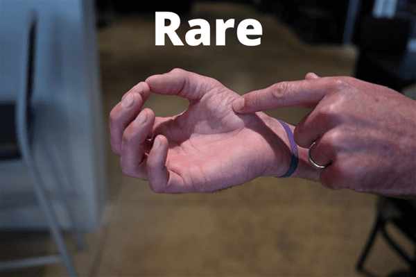Rare